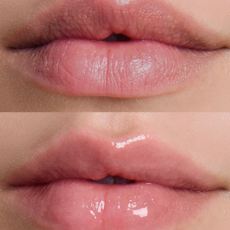 Balm treatment for lips Lip Hydrater